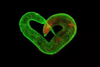 ���x�@΢ע����β�������Ԕ��(x��)��(sh��)�(y��n)���E����aס