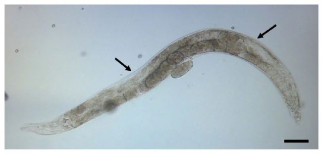 ���x�@΢ע����β�������Ԕ��(x��)��(sh��)�(y��n)���E����aס